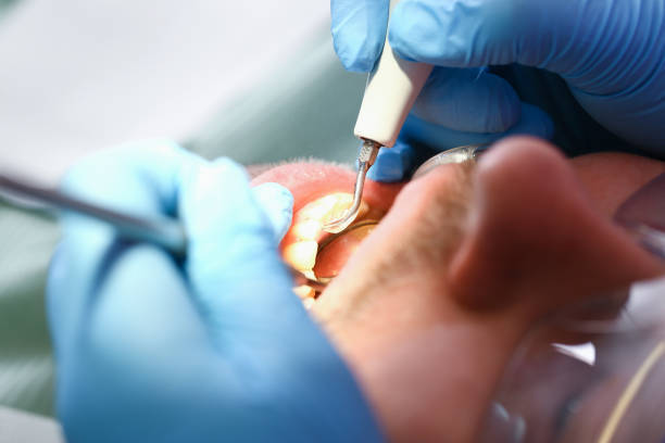 Best Emergency Dentist for Knocked-Out Tooth in Washington, UT