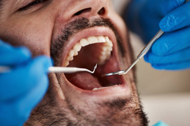 Best Emergency Dentist for Special Needs Patients in Washington, UT