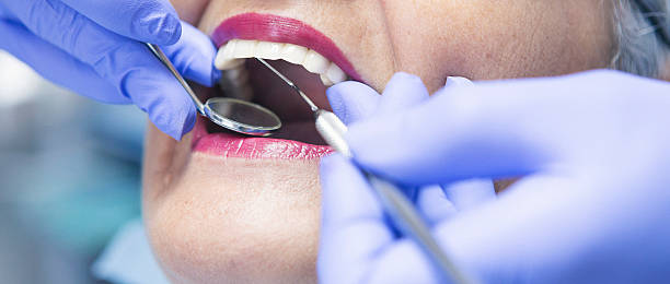 Best Broken or Cracked Tooth Emergency Dentist in Washington, UT